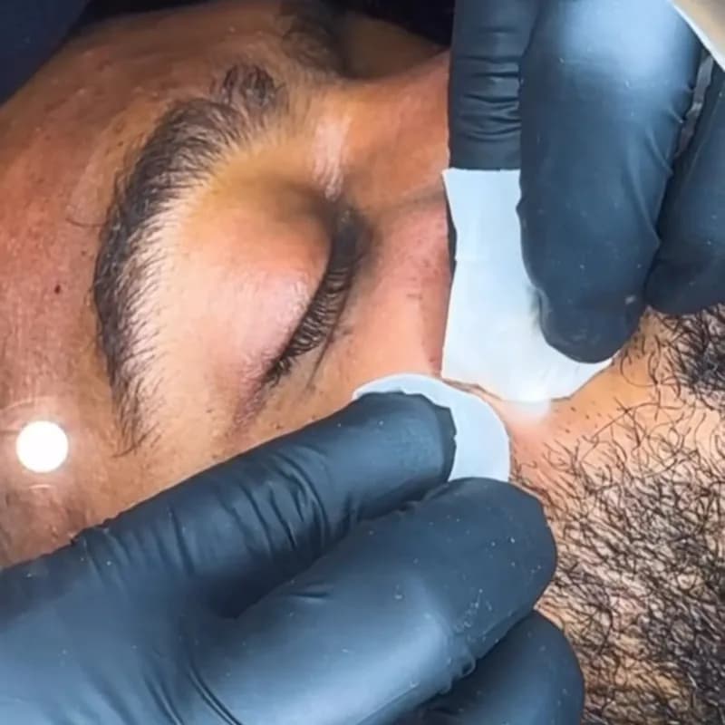 Tratamiento facial de cerca